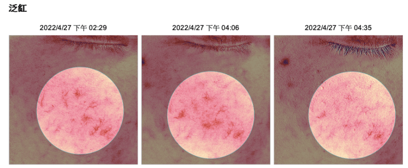 夏日不再當泛紅人了！敏弱肌、曬後急救都可以安心使用的LADOUCE 微分子透晶絲面膜