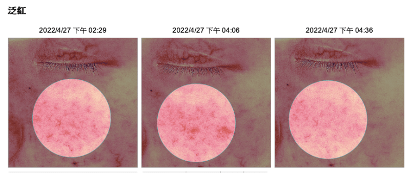 夏日不再當泛紅人了！敏弱肌、曬後急救都可以安心使用的LADOUCE 微分子透晶絲面膜